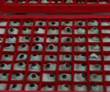 Prótese ocular produzida na IRO